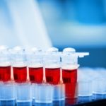 Labortests